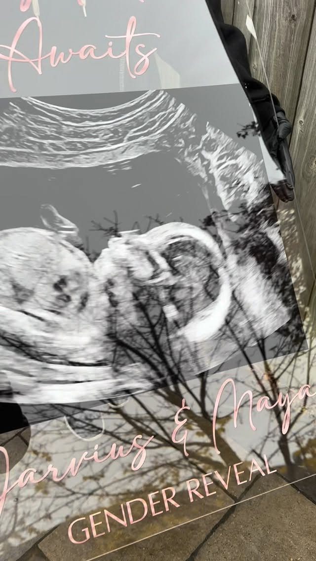 Acrylic sonogram frame with ultrasound image and pink gender reveal text.